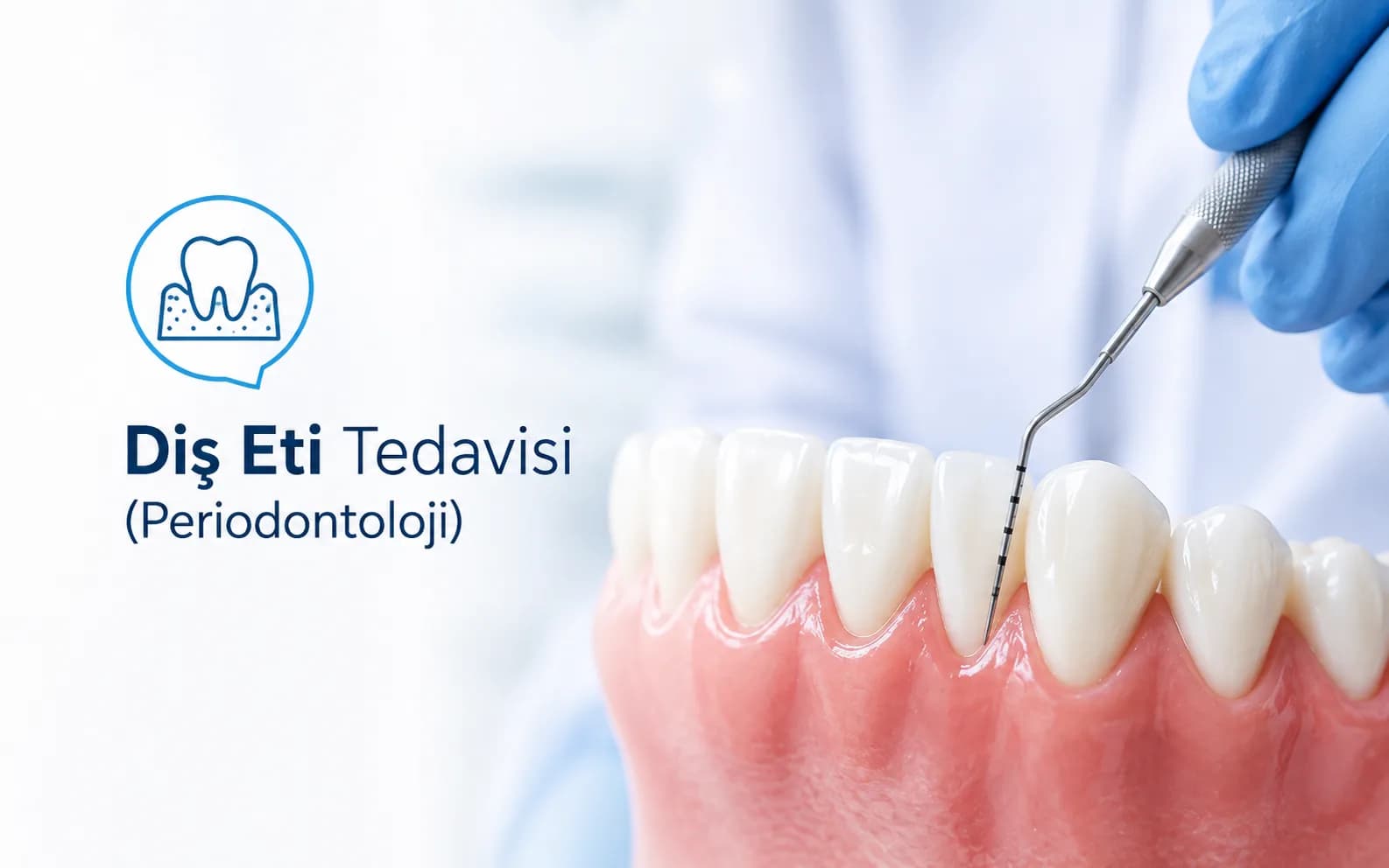 Diş Eti Tedavisi (Periodontoloji)