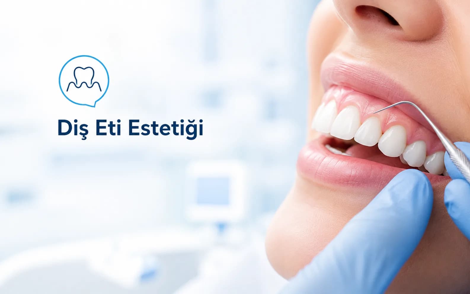 Diş Eti Estetiği