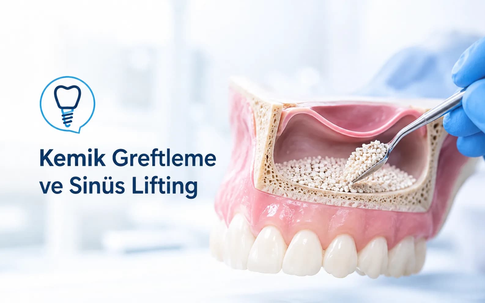 Kemik Greftleme ve Sinüs Lifting