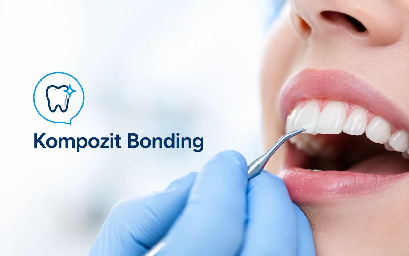 Kompozit Bonding
