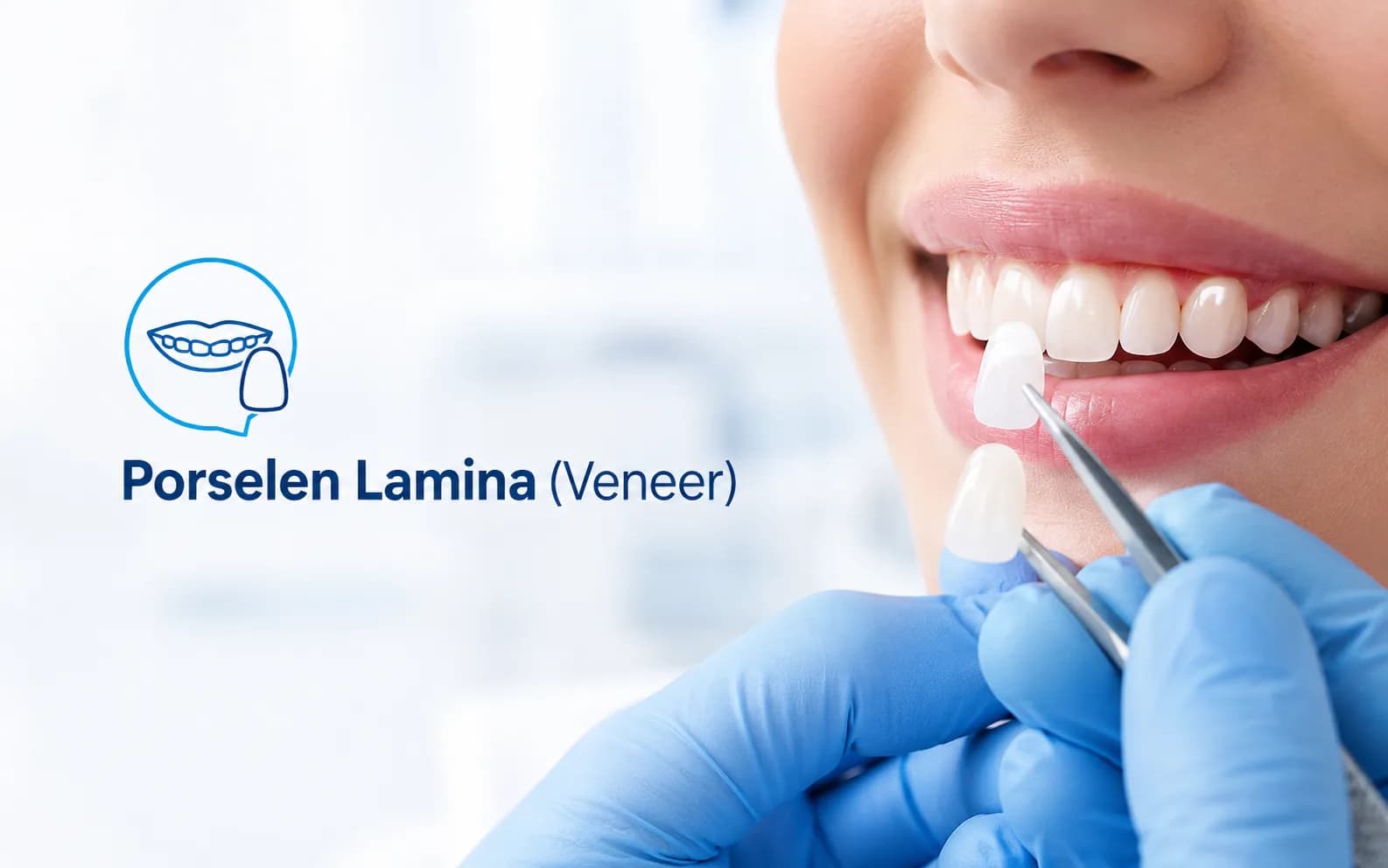 Porselen Lamina (Veneer)