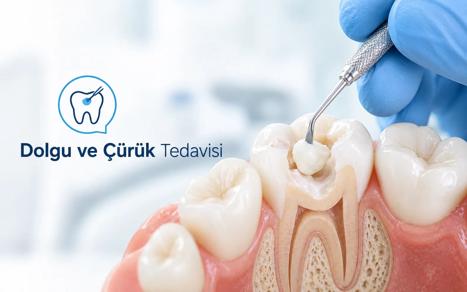 Dolgu ve Çürük Tedavisi