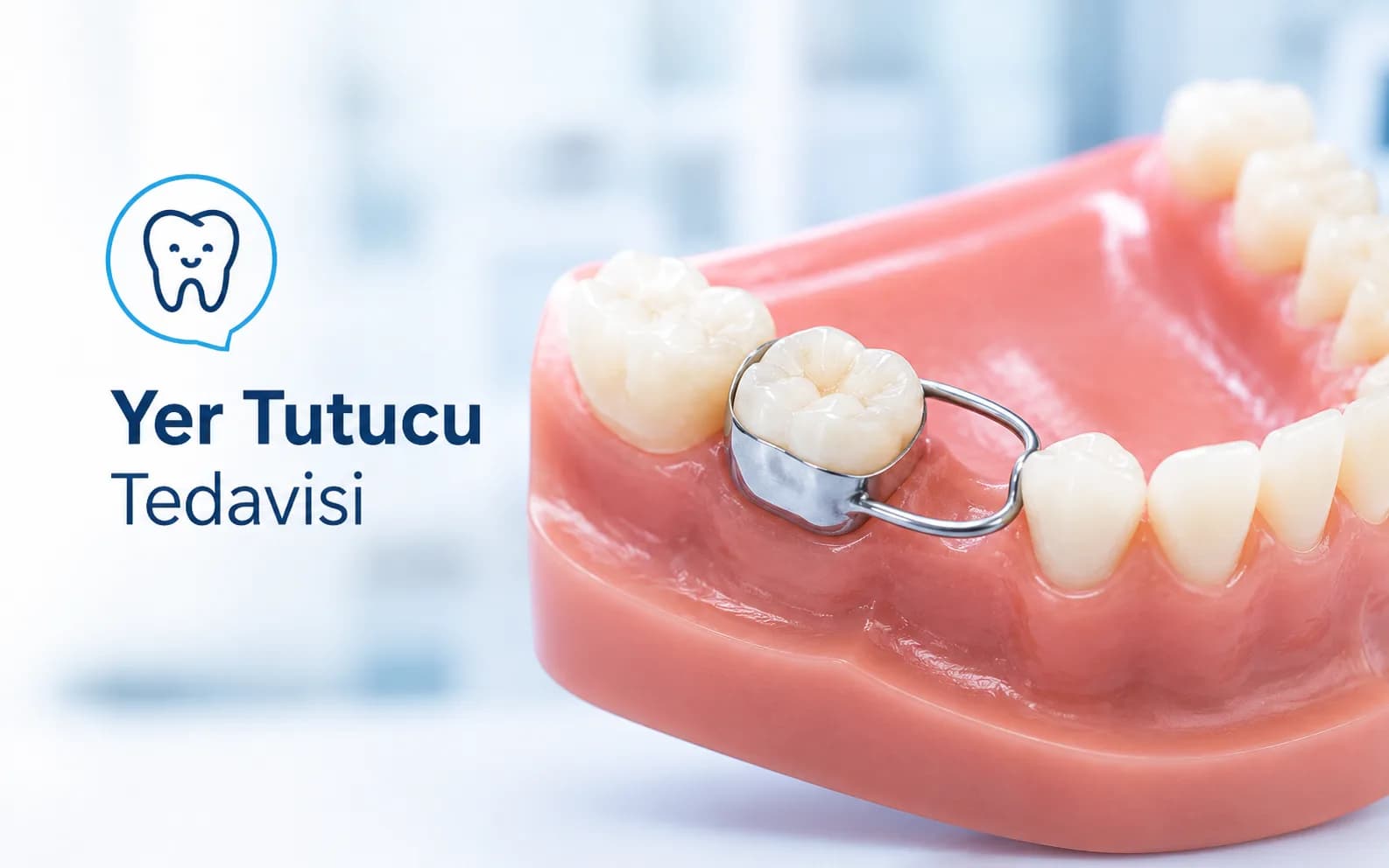 Yer Tutucu Tedavisi
