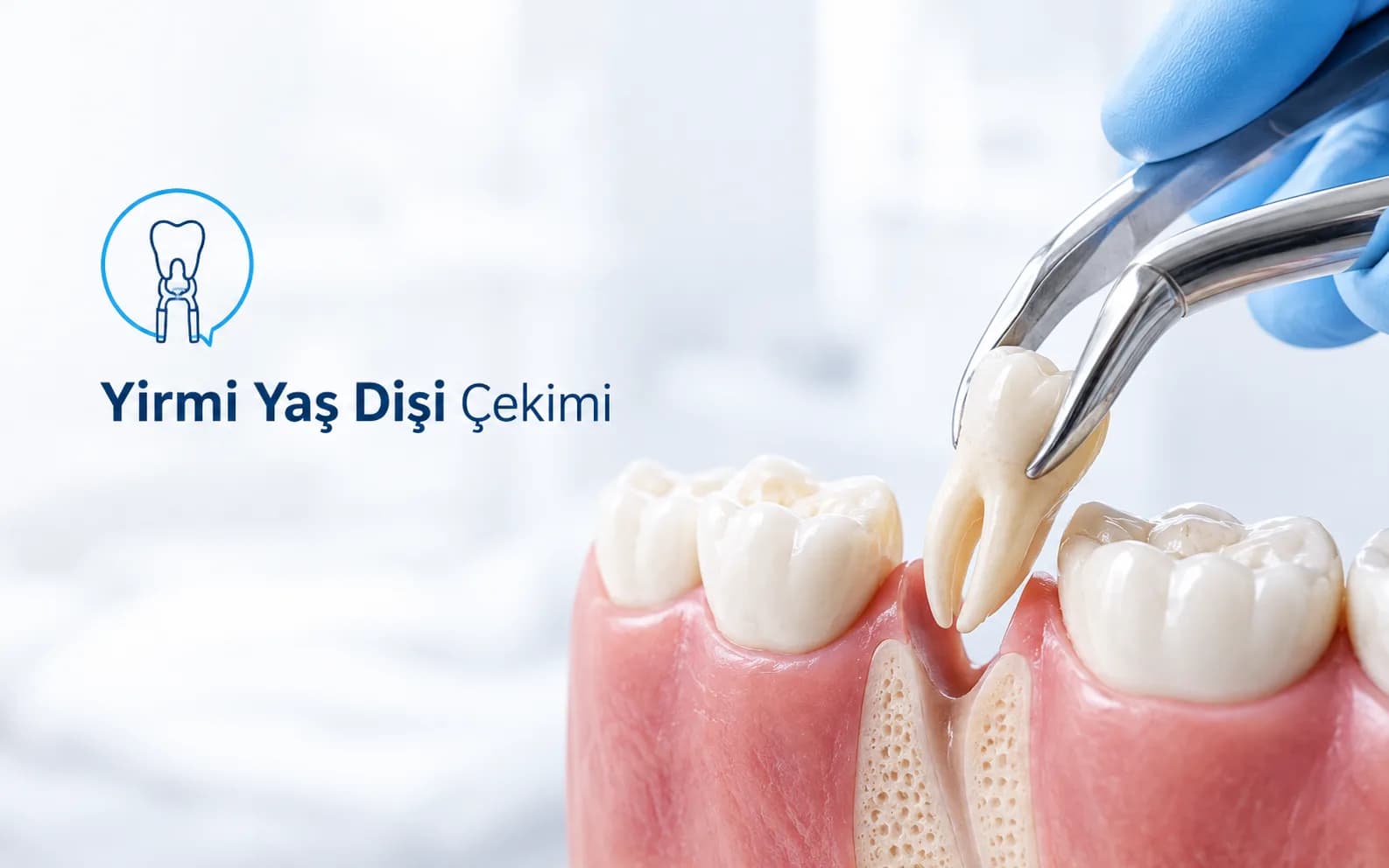 Yirmi Yaş Dişi Çekimi